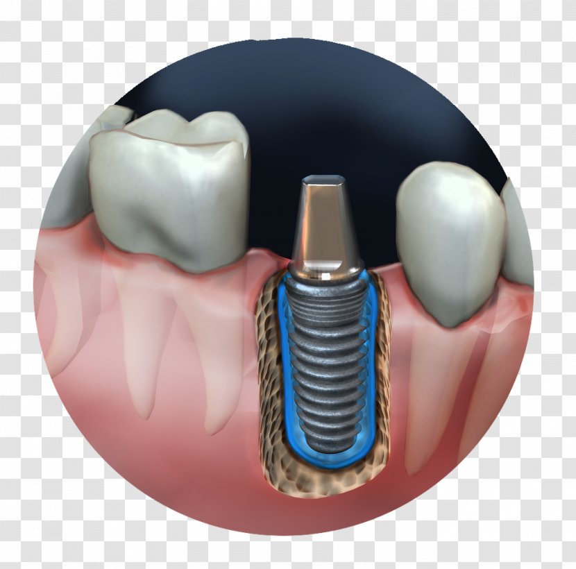 Jaw Medical Illustration Medicine - Human Tooth - Animated Film Transparent PNG
