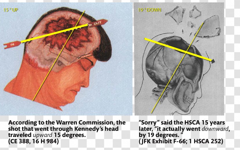 Assassination Of John F. Kennedy Conspiracy Theories Magic Bullet-teorien United States House Select Committee On Assassinations - Watercolor - Clea Transparent PNG