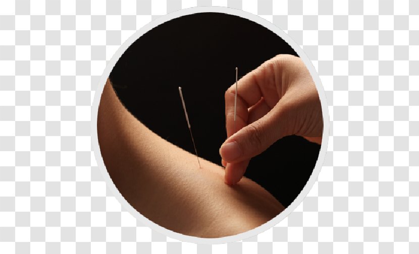 Acupuncture Therapy Traditional Chinese Medicine Health Transparent PNG