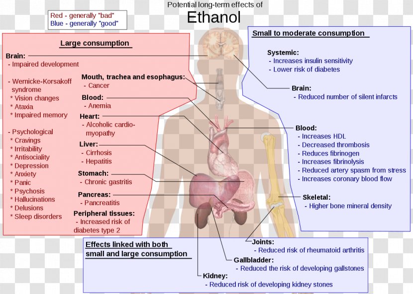 Long-term Effects Of Alcohol Consumption Alcoholism Alcoholic Drink Ethanol And Health - Cartoon - Symptoms Transparent PNG