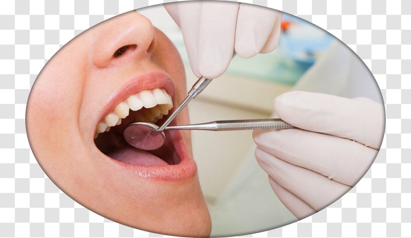 Cosmetic Dentistry Dental Surgery Medicine - Medical Procedure - Health Transparent PNG