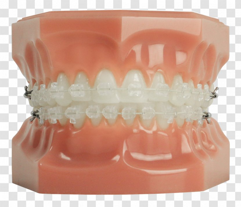 Human Tooth Dental Braces Clear Aligners Dentistry - Jaw - Teeth Model Transparent PNG