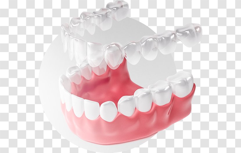 Tooth Элайнер Dental Braces Clear Aligners Zwarcie - Smile Transparent PNG