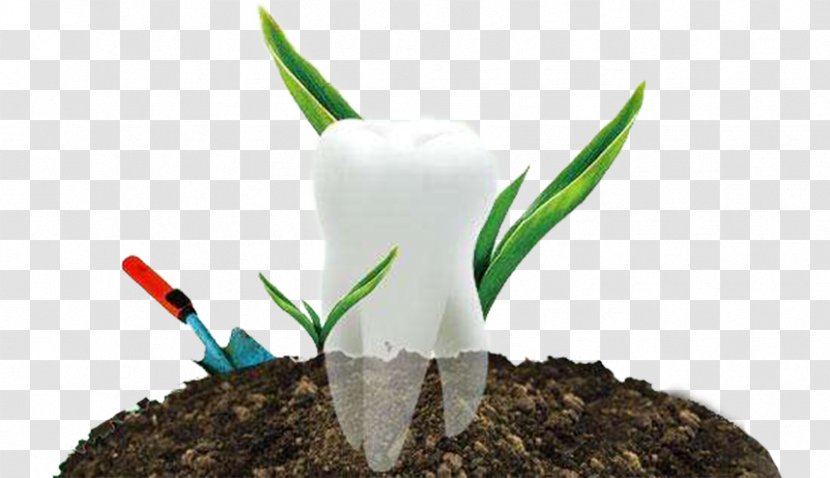 Tooth Whitening Dentures Dental Implant Mouth - Creative Planting Teeth Transparent PNG