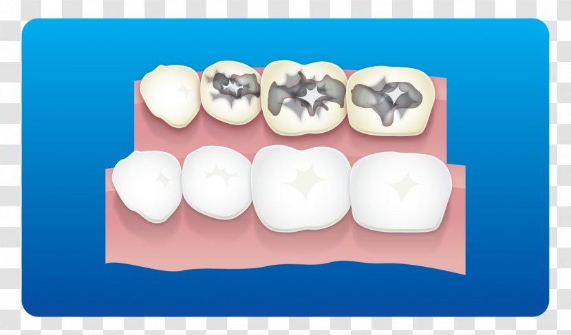 Tooth - Frame - Cartoon Transparent PNG