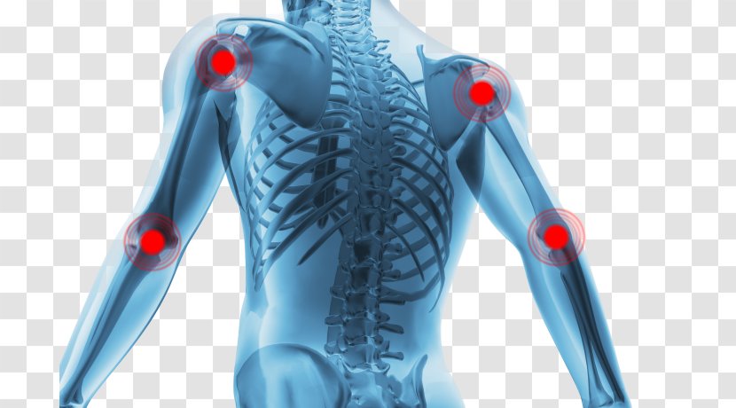 Joint Pain Knee Osteoarthritis Inflammation - Synovial Bursa - Neck Transparent PNG