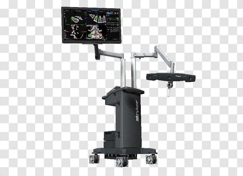 Stryker Corporation Computer-assisted Surgery Navigation System - Machine Transparent PNG