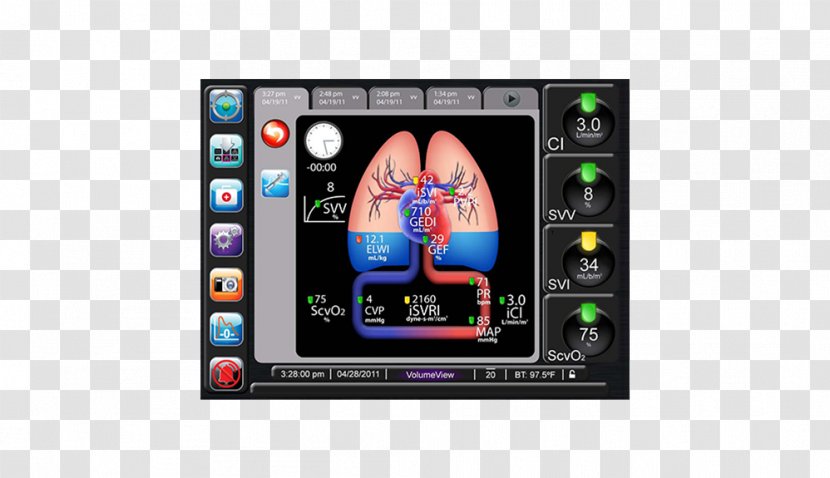 Cardiac Output Intensive Care Medicine PiCCO Edwards Lifesciences Monitoring - Masimo - Physiology Transparent PNG