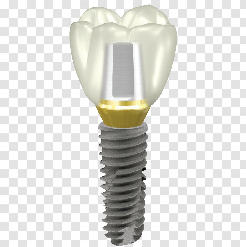 Dental Implant Abutment Dentistry OSSTEM IMPLANT - Tooth - Restoration Transparent PNG