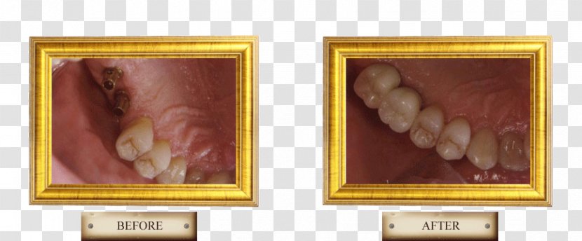 Painting Picture Frames Jaw Image - Smiling Buffalo Transparent PNG