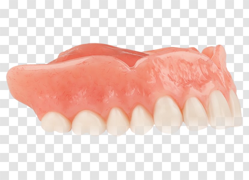 Tooth Dentures Dentistry YouTube - Mouth - Aspen Dental Transparent PNG