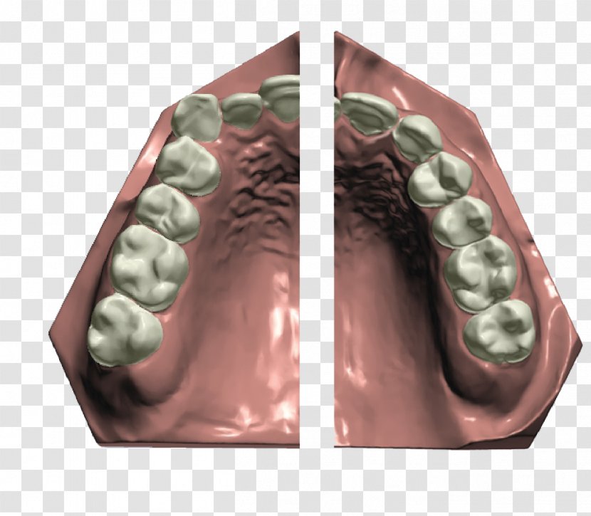 Orthodontics CAD/CAM Dentistry Dental Implant Braces - Praline Transparent PNG