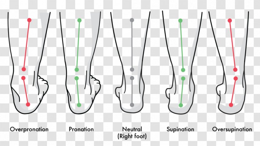 Pronation Of The Foot Supination Gait Achilles Tendinitis - Text Transparent PNG