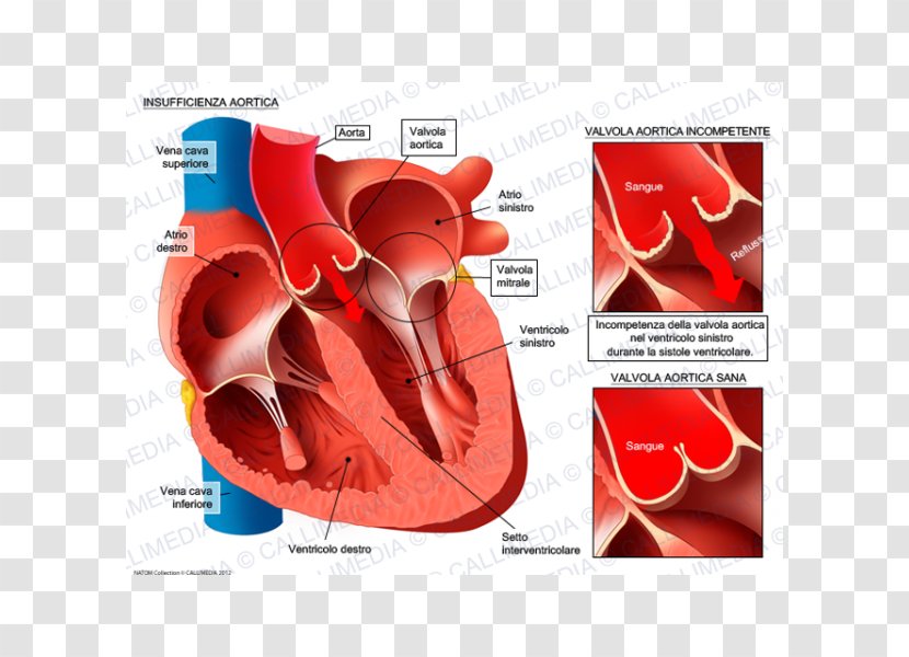 Valvular Aortic Stenosis Insufficiency Valve Mitral - Watercolor - Heart Transparent PNG