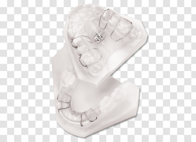 Twin Block Appliance Home Bionator Retainer Open Bite Malocclusion - Premolar Transparent PNG