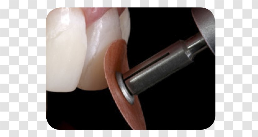 Nail Polishing Diamond Cutting - Time - Bad Tooth Transparent PNG