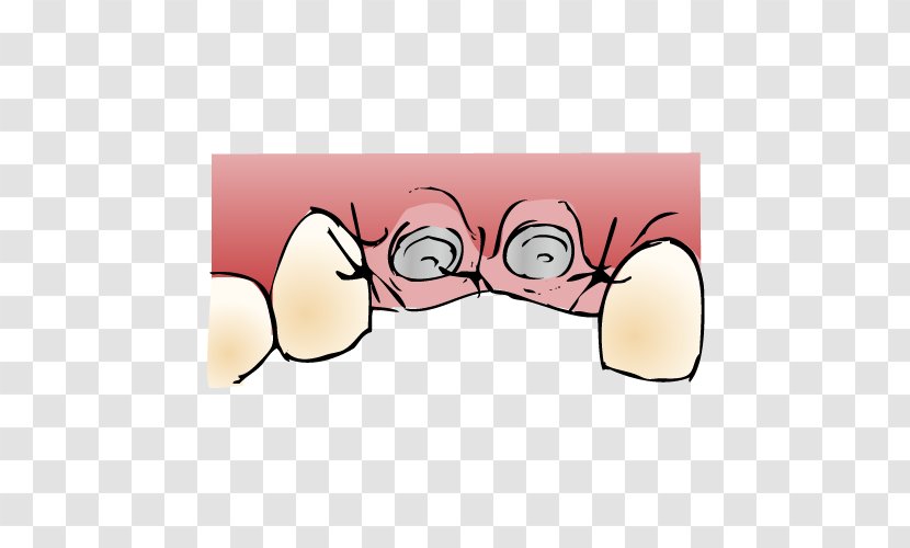 Glasses Ear Cartoon - Frame Transparent PNG