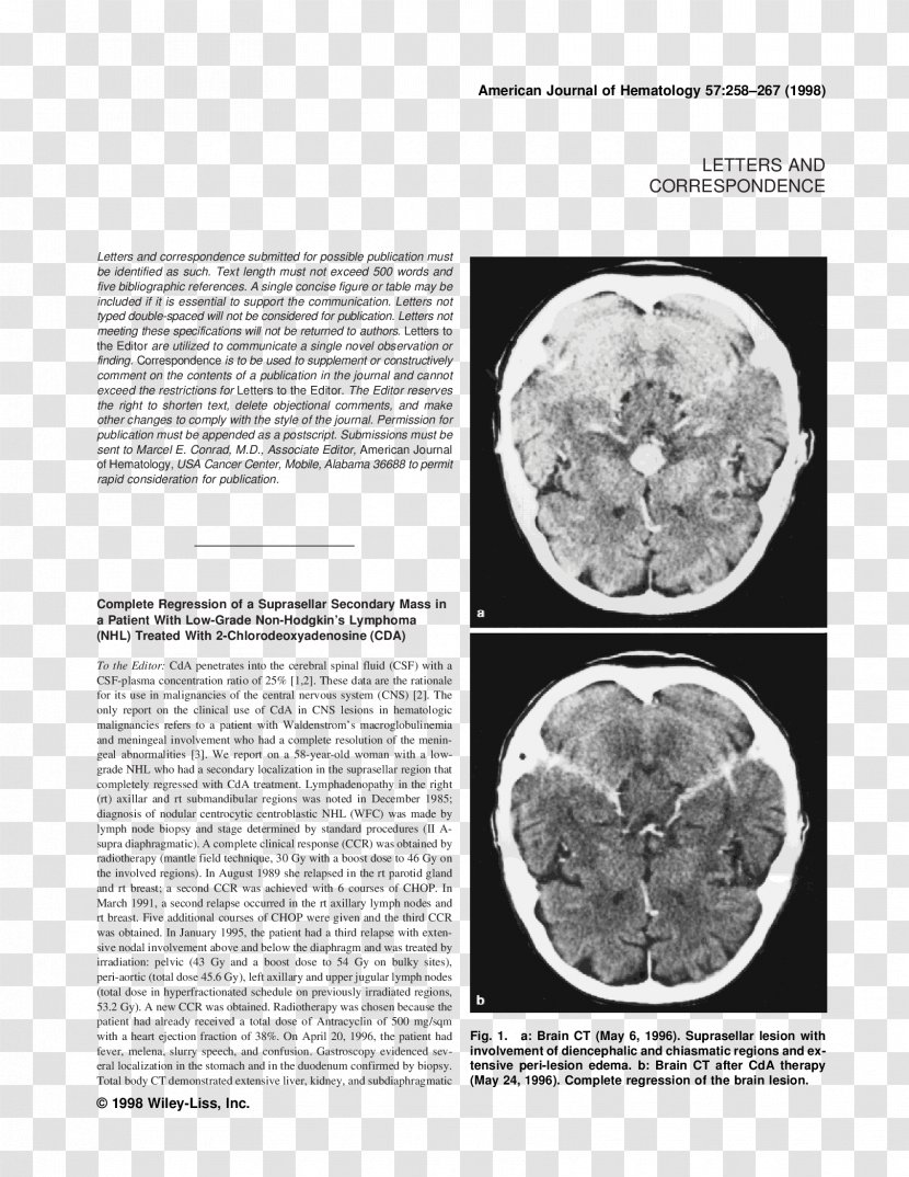 Brain Organism White Font Transparent PNG