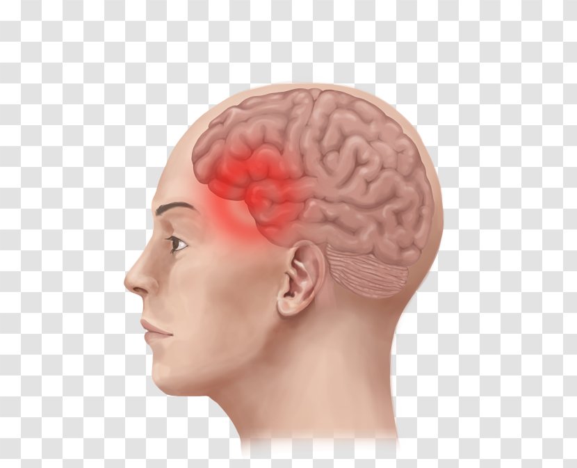 Migraine Tension Headache Therapy - Flower - Ear Transparent PNG