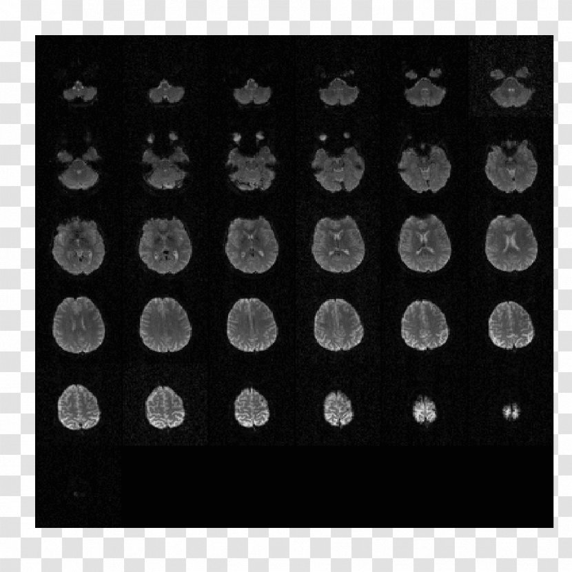 DICOM Single-photon Emission Computed Tomography Magnetic Resonance Imaging - Scintigraphy - Mosaic Transparent PNG