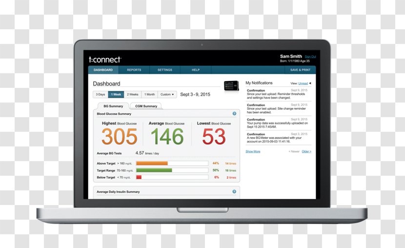 Computer Software Insulin Pump Diabetes Management Tandem Care Transparent PNG