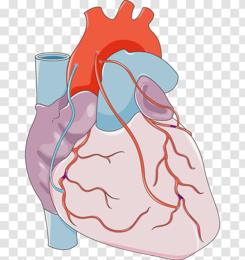 Heart Coronary Artery Bypass Surgery Vascular Arteries - Frame Transparent PNG
