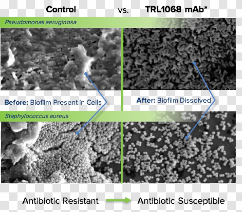 Soil Bacteria Antibody Broad-spectrum Antibiotic Chemical Affinity - Broadspectrum - Organism Transparent PNG