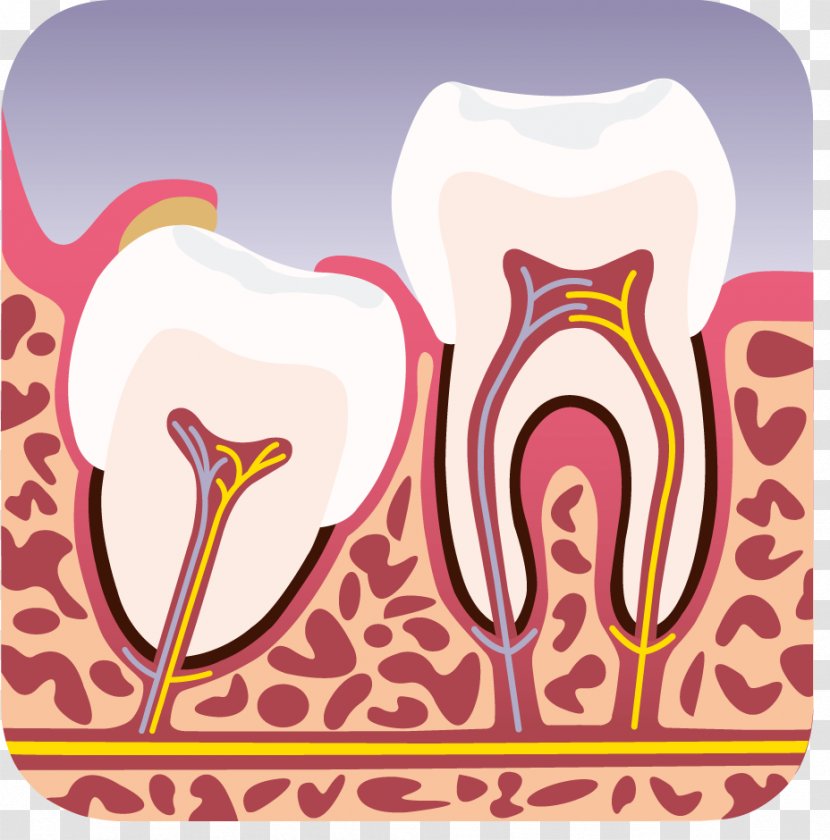 Wisdom Tooth Horten Tannlegesenter DA Dental Extraction Dentist - Silhouette - Cartoon Transparent PNG