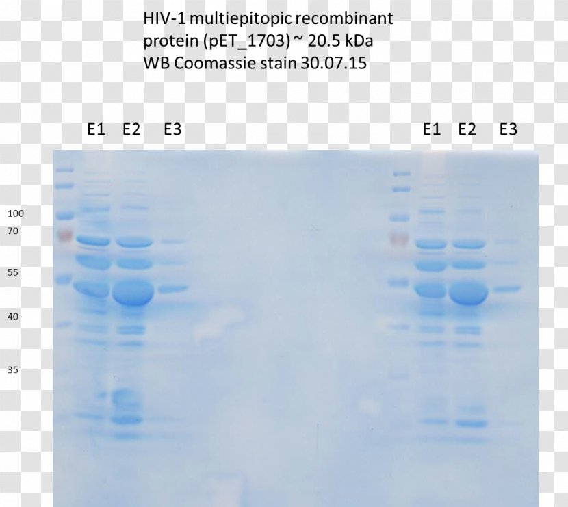 Coomassie Brilliant Blue Amido Black 10B Western Blot Staining AIDS - Sky - Clostridium Tetani Transparent PNG