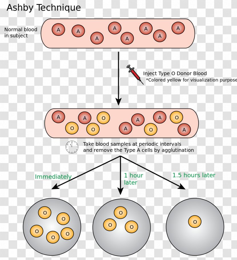 Ashby Technique Hematology Red Blood Cell Donation - Area Transparent PNG