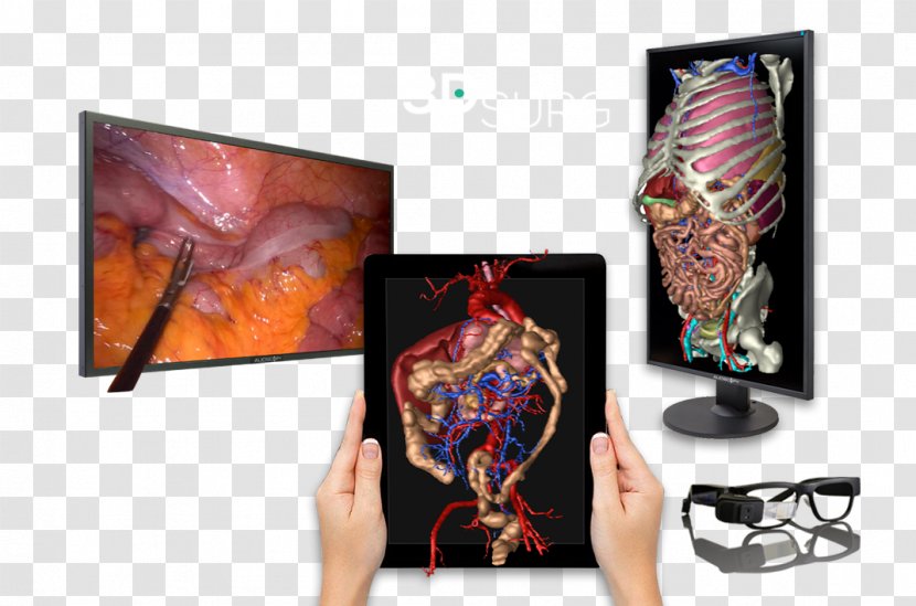 Surgery Patient Information Three-dimensional Space Medicine - Surgical Technologist Transparent PNG