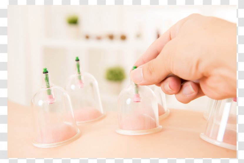 Cupping Therapy Alternative Health Services Massage Medicine - Nail Transparent PNG