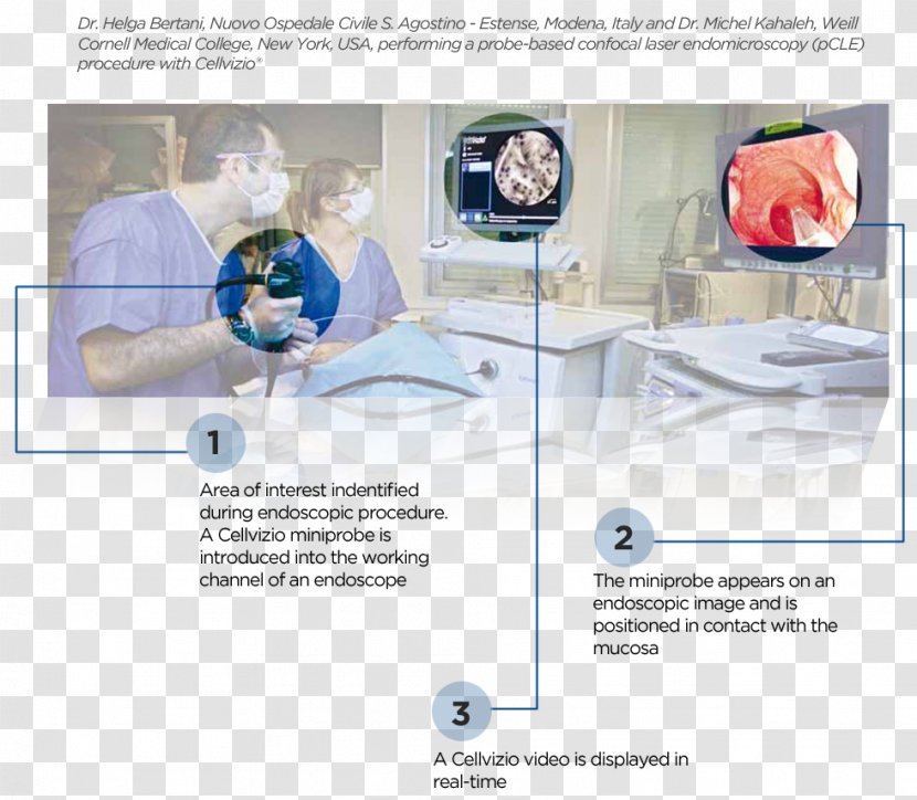 Endomicroscopy Confocal Microscopy Biopsi Endoscopy Colonoscopy - Large Intestine - Barrett's Esophagus Transparent PNG