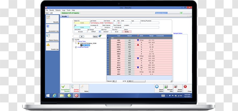 Computer Program Engagio Software Analytics IBM - Media - Manual Testing Transparent PNG