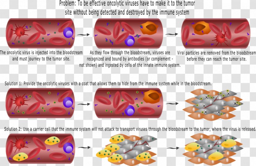 Oncolytic Virus Virotherapy Immune System Cancer - Cell - Planar Bodies Transparent PNG