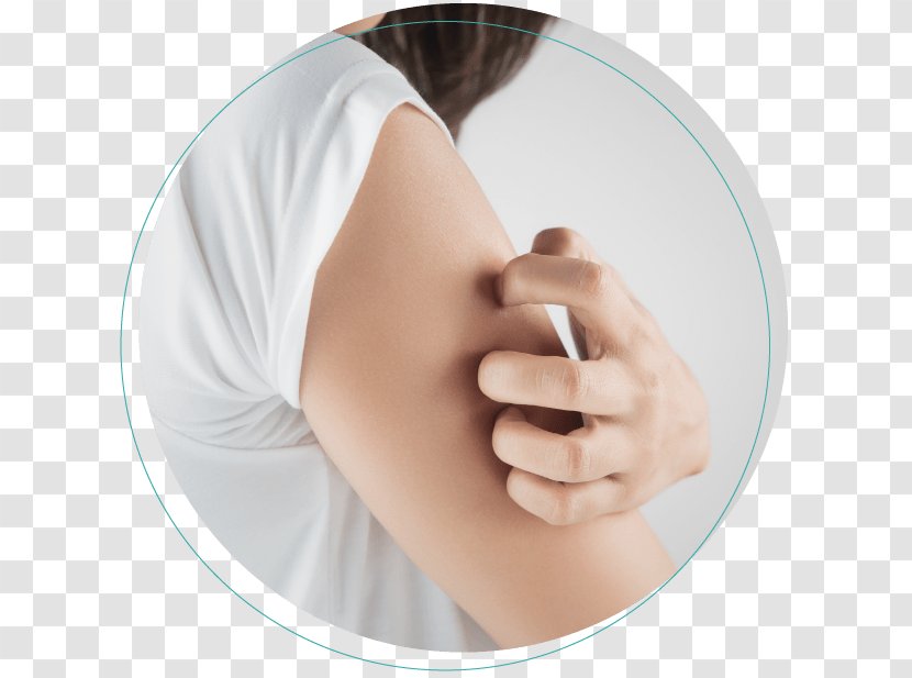 Itch La Peau Dermatology: Zaina Rashid, DO, FAOCD, FAAD Skin Rash Tinea Cruris Symptom - Dermatitis - Arm Transparent PNG