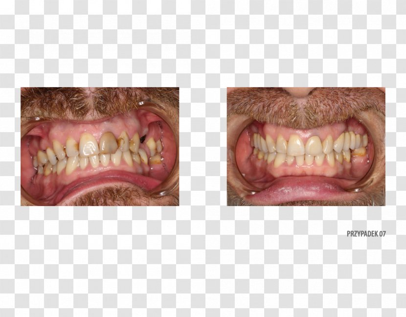 Dr. Brett Egelske Lombard Street Jaw Dentistry Yelp - Silhouette - Medycyna Estetyczna Transparent PNG
