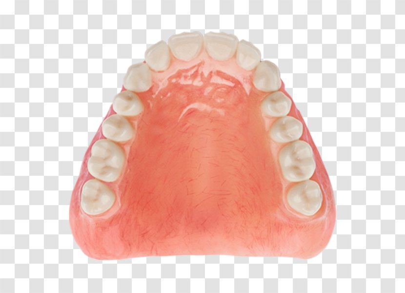 Tooth Dentures Dentistry Diagnostic Wax-up - Dentist - Aspen Dental Transparent PNG