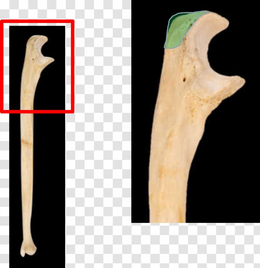 Collection 97+ Pictures which bone has both a coronoid and a styloid process Updated