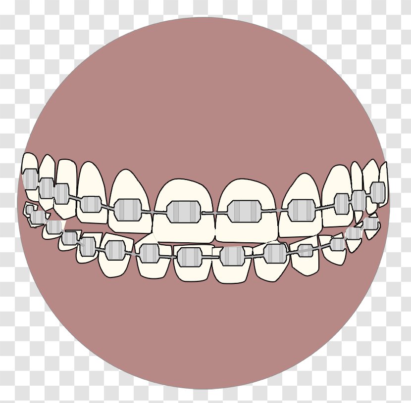 Tooth Whitening Velopex International Dental Abrasion Air-Polishing - Frame - Ortho Transparent PNG