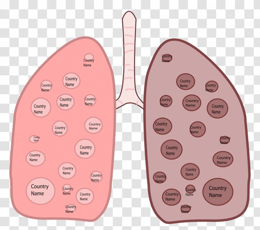Smoking Cessation Lung Tuberculosis Cannabis - Cancer - Lungs Transparent PNG