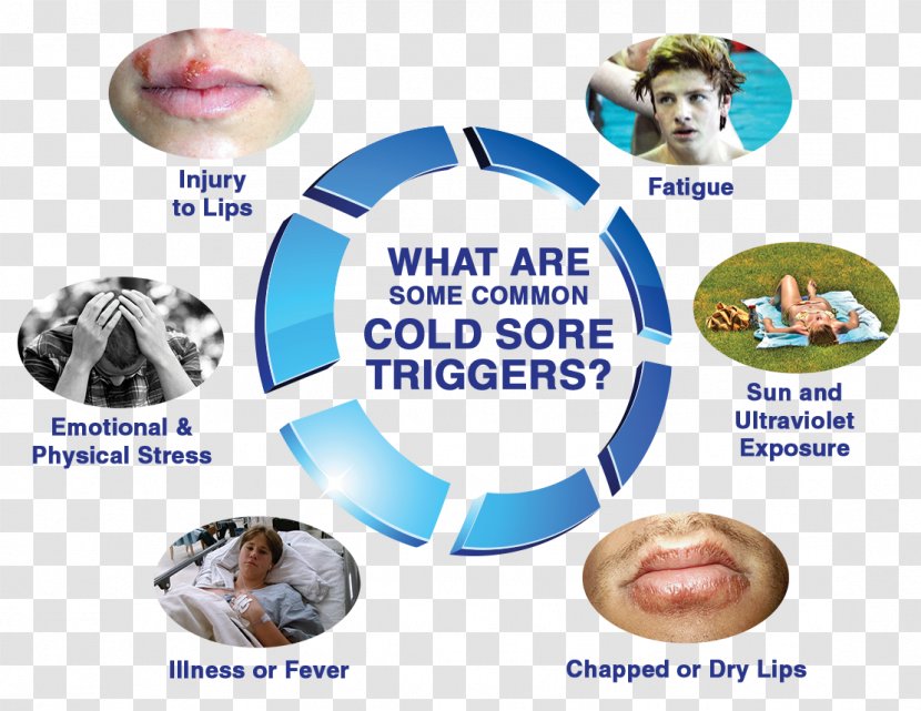 Herpes Labialis Canker Sore Wiring Diagram Common Cold Throat - Earthquake Causingg Transparent PNG