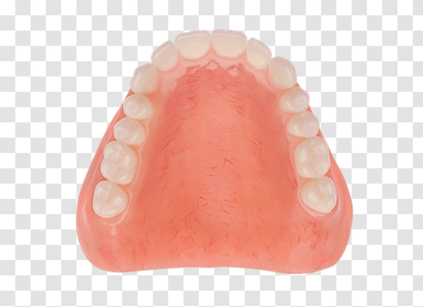 Dentures Tooth Dentistry Acrylic Resin Poly - Tissue - Aspen Dental Transparent PNG