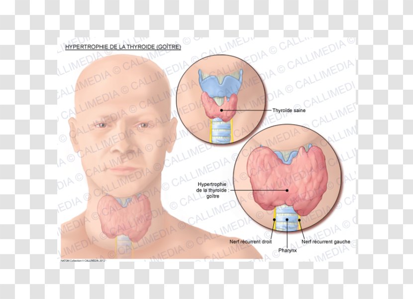 Goitre Graves' Disease Thyroid Cancer - Heart - Acromegaly Transparent PNG