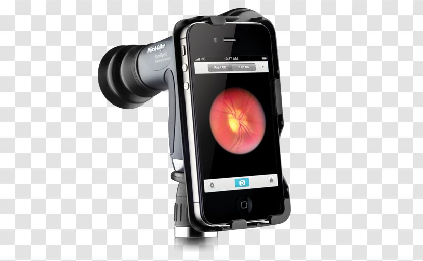 IPhone 4S 6 Welch Allyn Ophthalmoscopy - Iphone 4 - Technology Transparent PNG