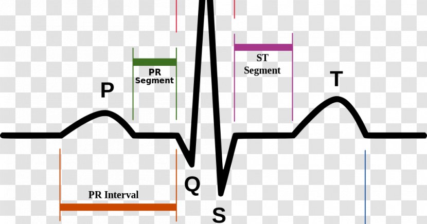 Electrocardiography Heart Rate Pulse Diagram - Tree Transparent PNG