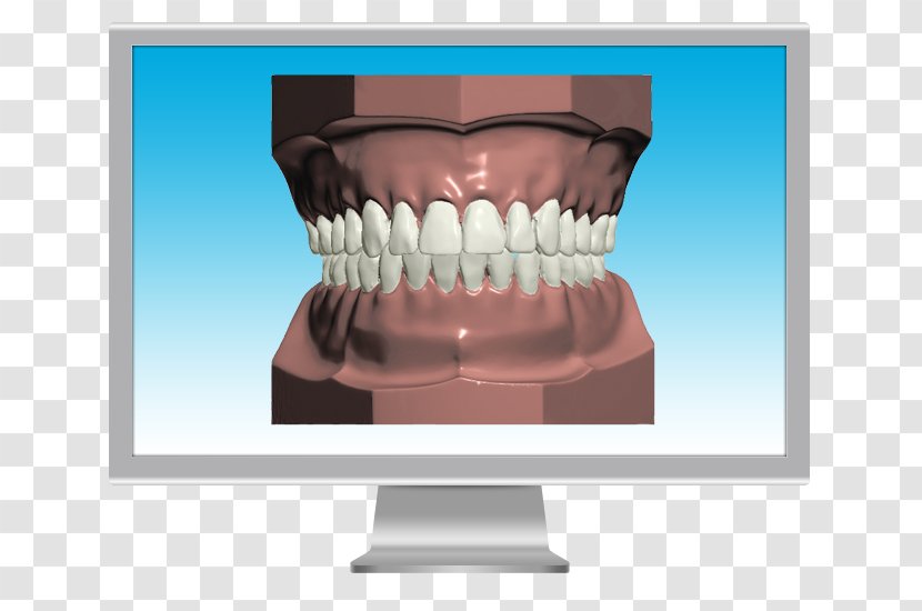Human Tooth Jaw Mandible Animal Bite - Tree - Dental Health Restoration Chart Transparent PNG
