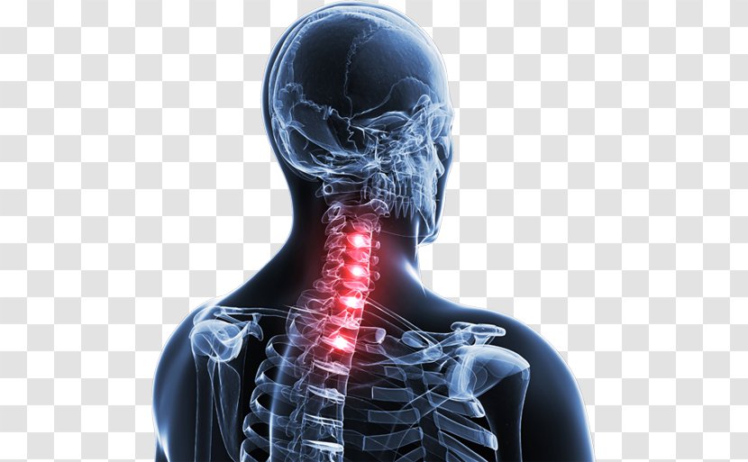 Spinal Disc Herniation Neck Pain Vertebral Column Thoracic Vertebrae - Heart Transparent PNG