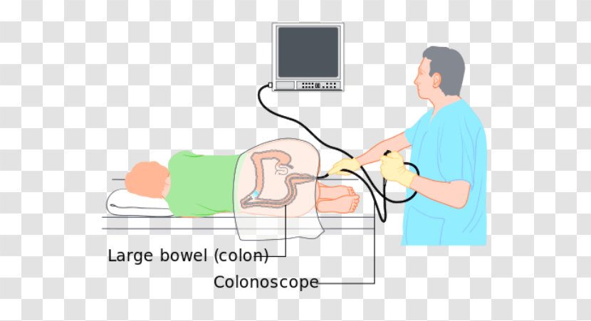 Colonoscopy Wiring Diagram Large Intestine Diverticulosis - Watercolor - Anxious Patient Nurse Transparent PNG