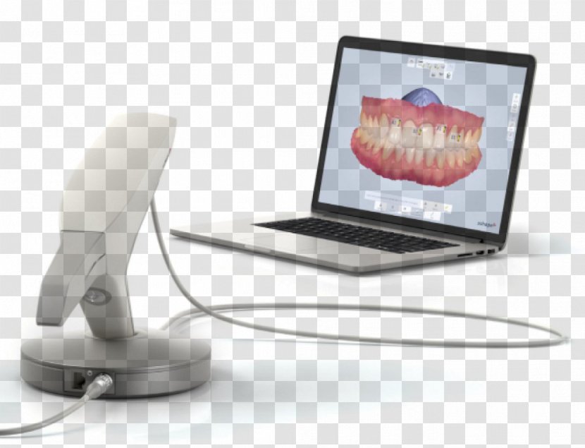 3Shape Dentistry Image Scanner 3D - Dental Implant - Cadcam Transparent PNG